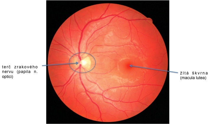 fotofrafia sietnice ľavého oka